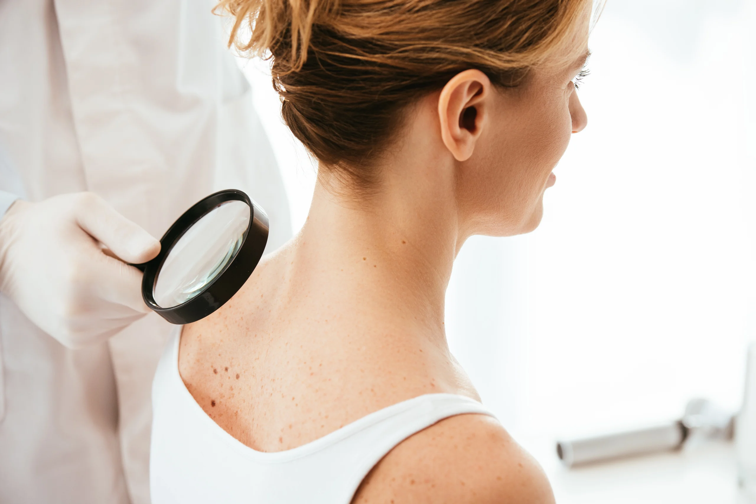 Neck Acne